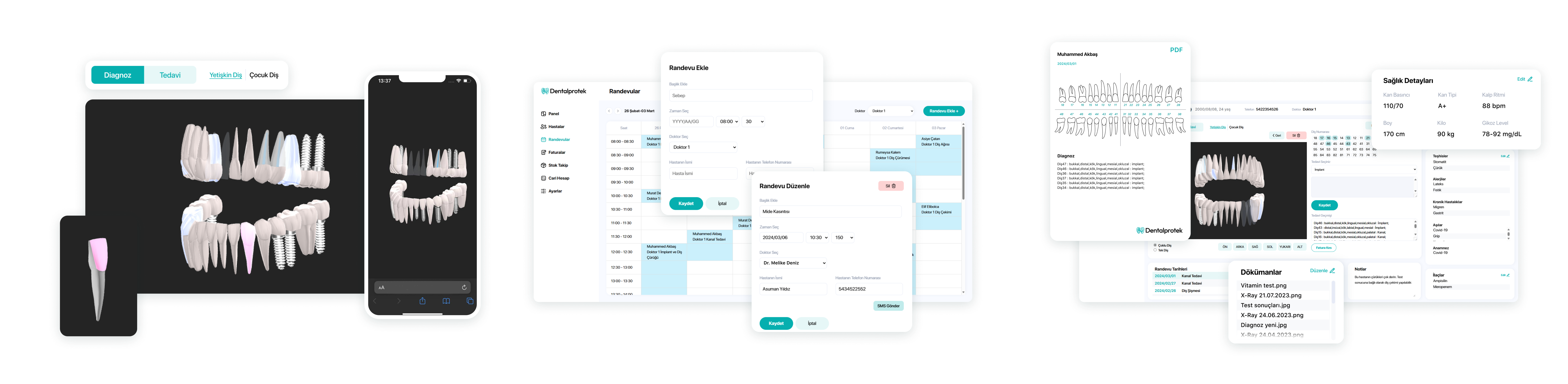 Dentalprotek Features Dentalprotek Features