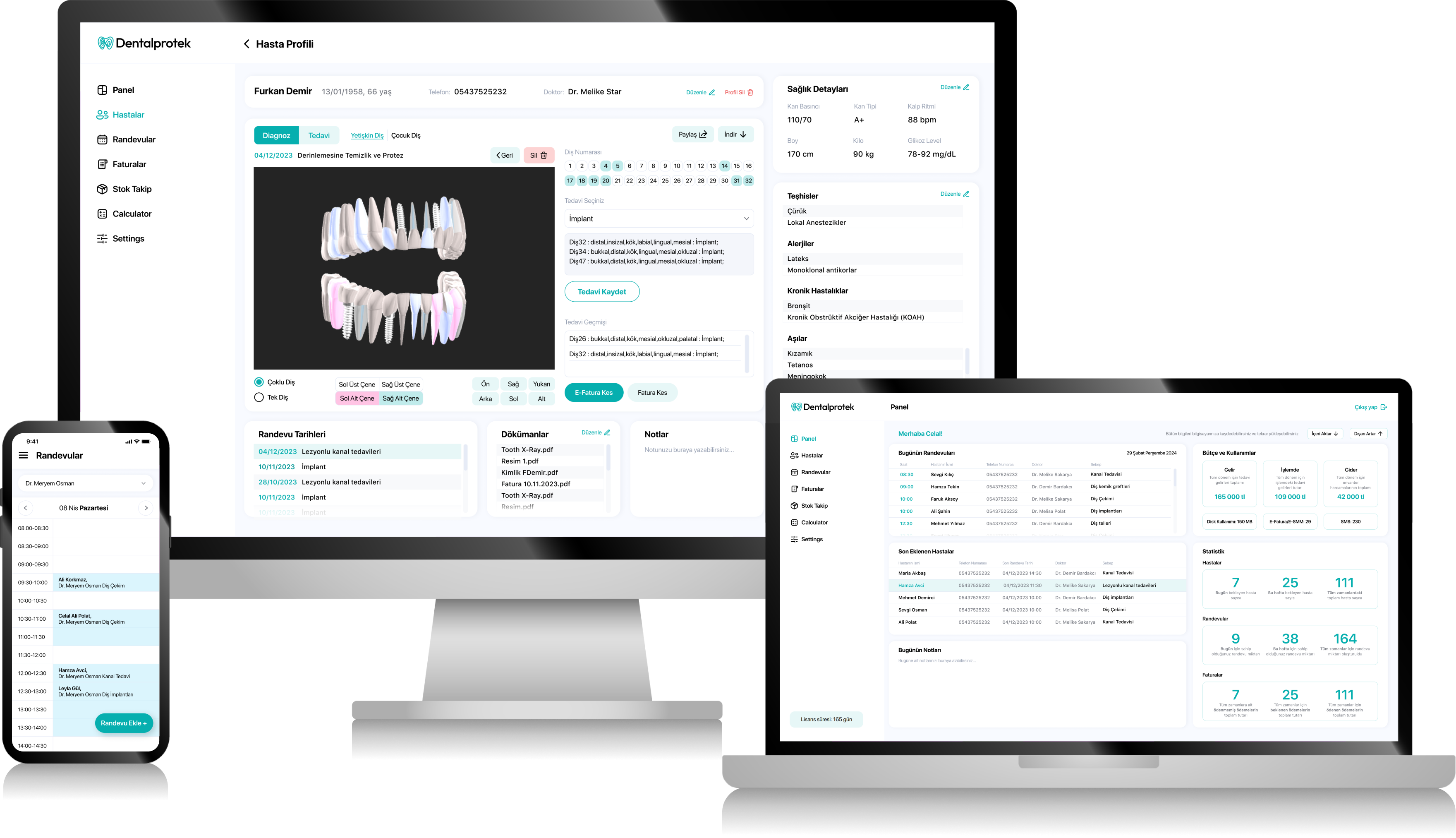 Dentalprotek screens